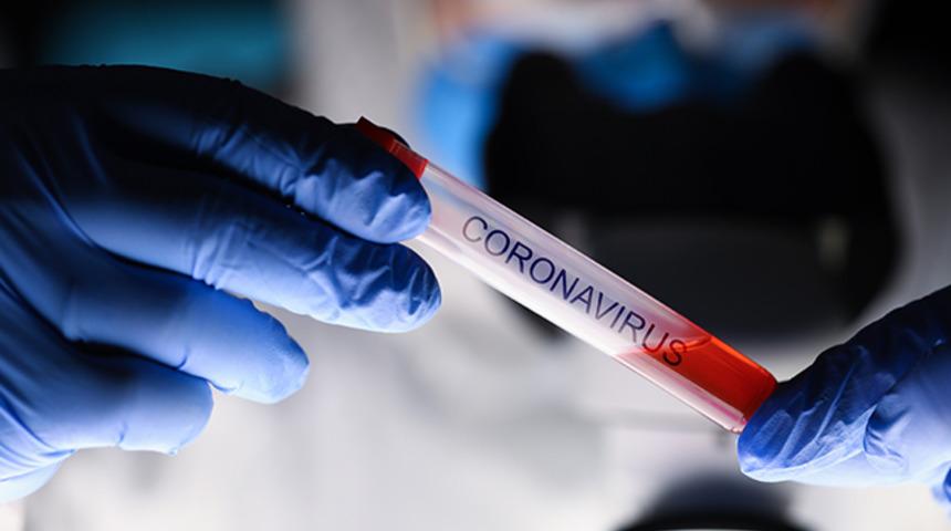 Koronavirüs geçiren erkeklerde kısırlık tehlikesi