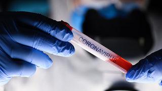 Koronavirüs geçiren erkeklerde kısırlık tehlikesi