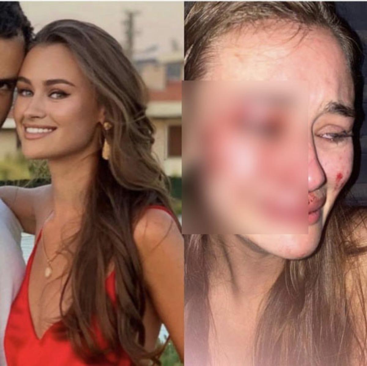 &Ccedil;eşme&rsquo;de darp edilen Ukraynalı model Daria Kyryliuk'tan cesur pozlar