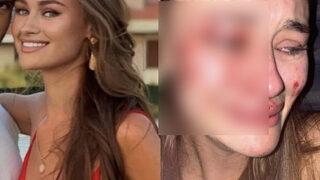 Çeşme’de darp edilen Ukraynalı model Daria Kyryliuk'tan cesur pozlar