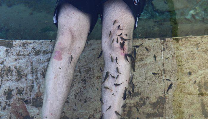 Sivas’ın Kangal ilçesinde bulunan doktor balıklar şifa saçıyor