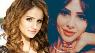 Estetikle Michael Jackson'a benzetilen Günel Zeynalova estetiksiz halini paylaştı