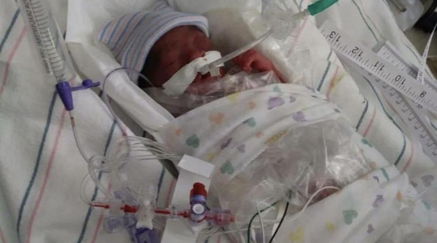 ''Doktorlar yaşamaz'' dedi, mucizeyi başardı! Bir paket şekerden bile daha hafifti