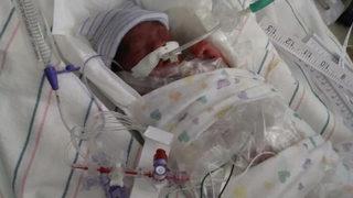 ''Doktorlar yaşamaz'' dedi, mucizeyi başardı! Bir paket şekerden bile daha hafifti