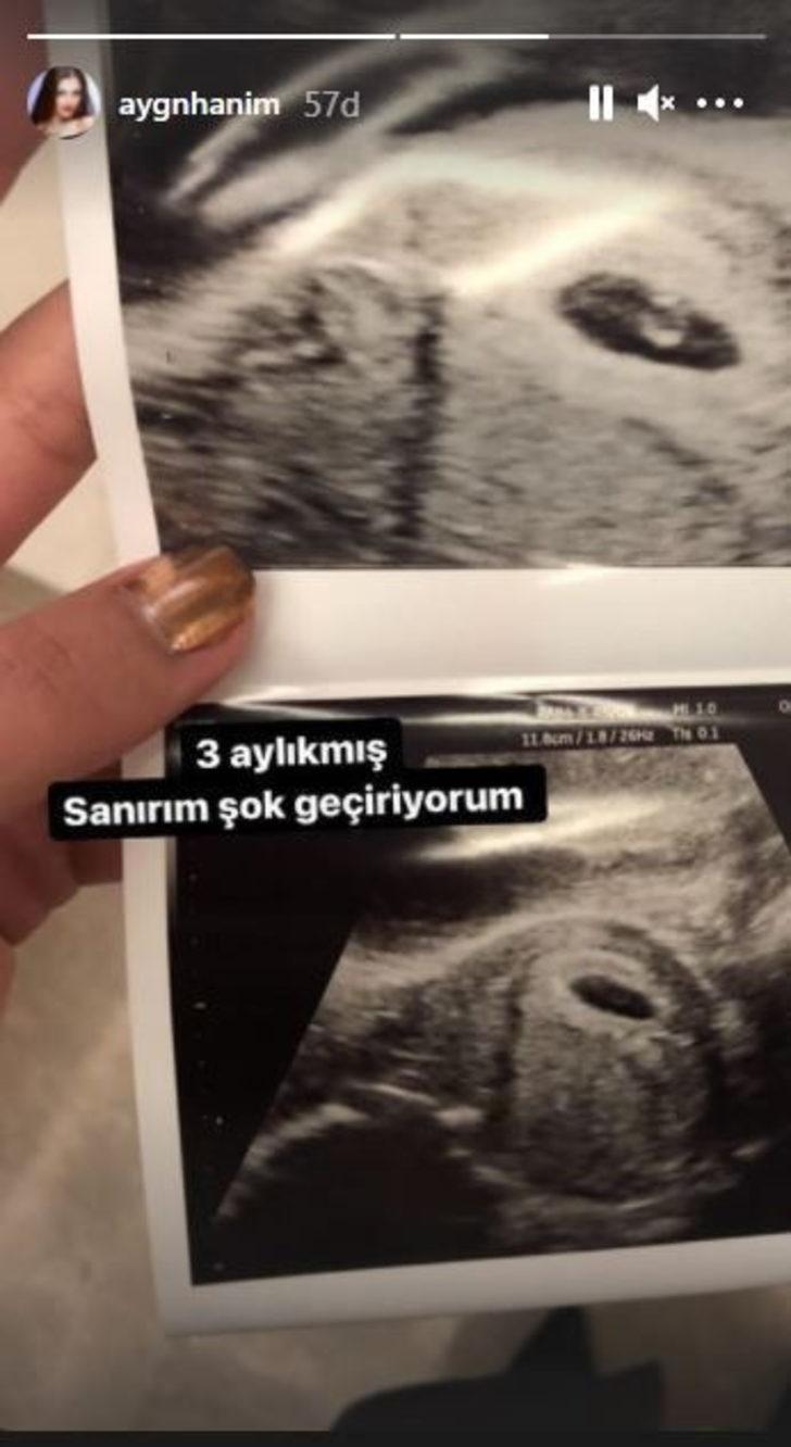 Aygün Aydın hamile mi? Sosyal medya sallandı  G3