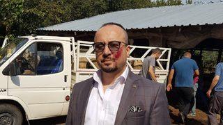 Haciz sırasında avukatın yanağını ısıran kişiye hapis cezası