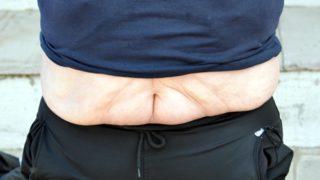 Sevgilisi beğenmeyince 6 ayda 212 kilo verdi: Kilo verdiğime sevinemedim