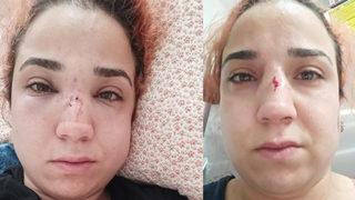 Kadın çalışandan patronuna 'süpürgeyle dövdü' suçlaması