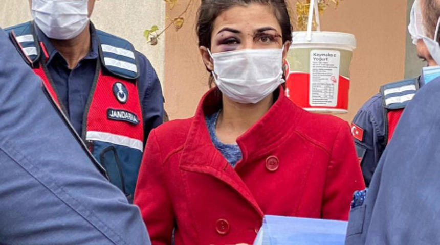 İşkenceci koca sadece Melek'e değil, Melike'ye de hayatı zindan etmiş: Şimdi saçını kestim, sonra boğazını keseceğim