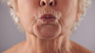 Dudaklardaki yaşlanma belirtileri kolay ve ağrısız bir şekilde yok ediliyor