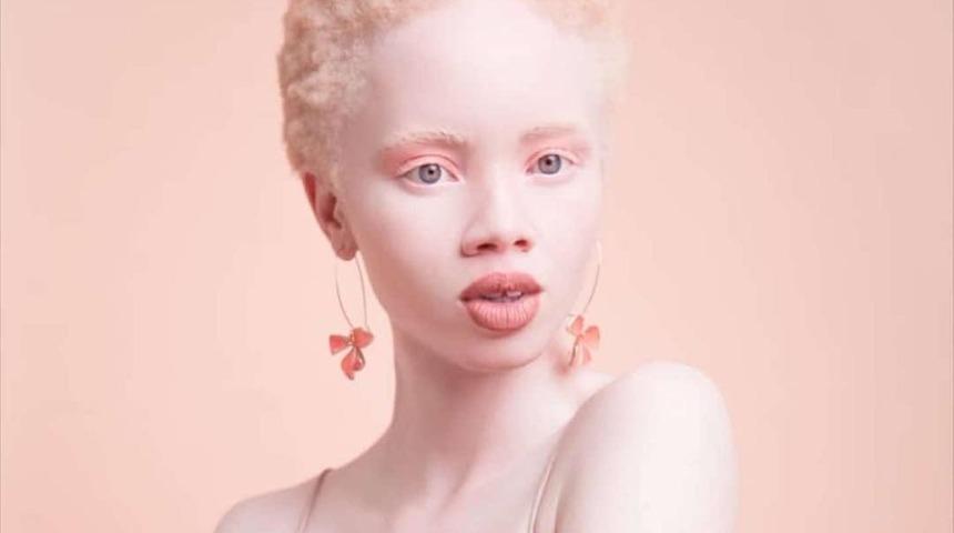 Toplumdaki güzellik algısını yerle bir ederek yepyeni bir model anlayışı yaratan 10 manken!