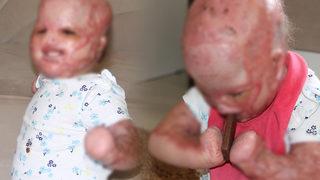 'Yüzde 90 yaşamaz' denilen Delal bebek doktorları bile şaşırttı!