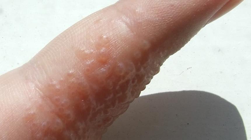 Güne, bir bardak idrar içerek başlıyor! ''13 kilo verdim, cildimin güzelliğini buna borçluyum''