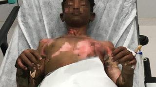 Ateşe tiner döktüler, sonrası korkunç!