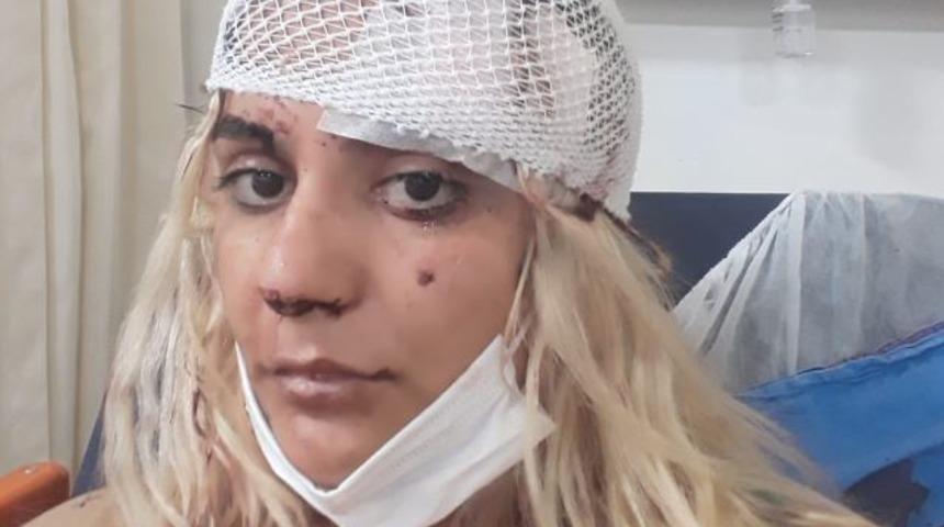 Her satırı korkun&ccedil;! Silah tutukluk yapınca kabzasıyla d&ouml;vd&uuml;