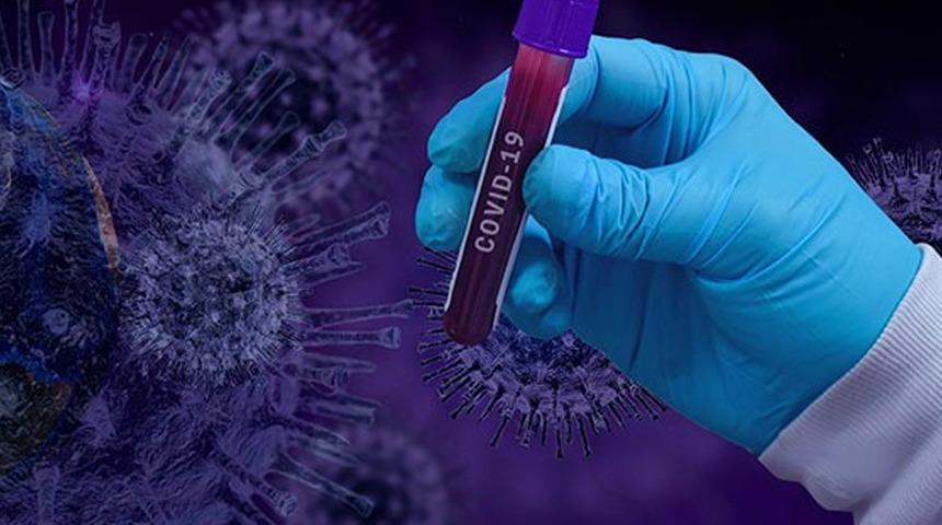 Malezya'da köpekten insana geçebilen koronavirüs türü bulundu