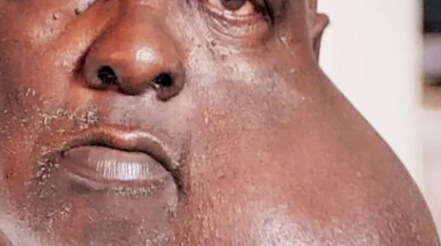 Yüzünde dünyanın en büyük tümörlerinden biri olan adamın ameliyatını ücretsiz yapan doktor sosyal medyada gündeme geldi