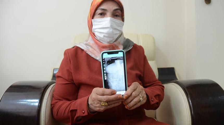 Karnında unutulan makasla 2 ay yaşadı