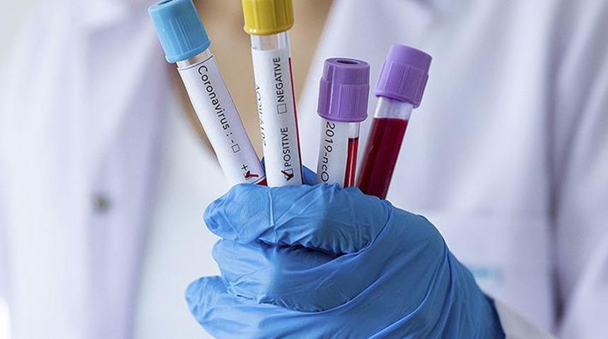 Koronavirüsle ilgili çarpıcı laboratuvar iddiası! Kanıtlandı mı?