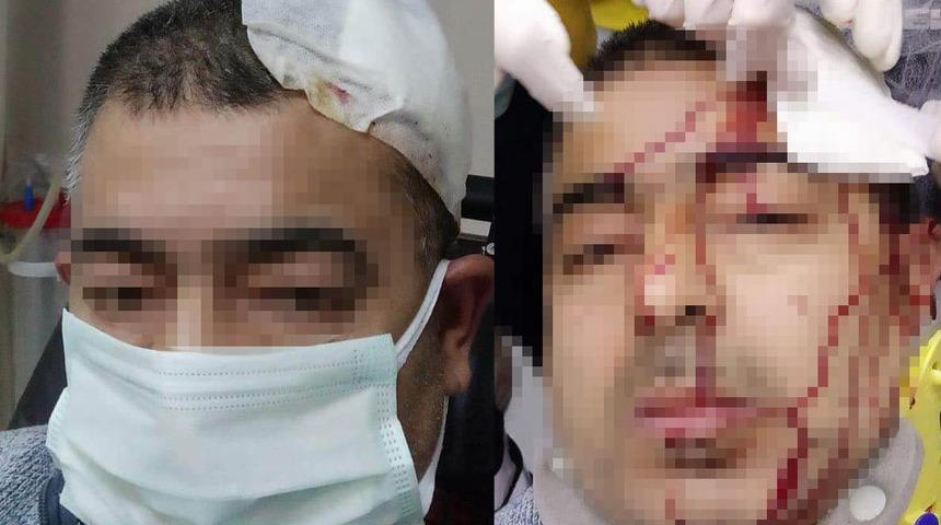 İmamın tabureyle saldırdığı müezzinin kafasına 10 dikiş atıldı