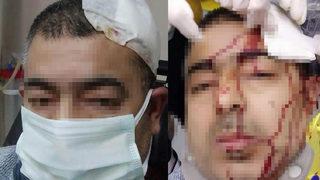 İmamın tabureyle saldırdığı müezzinin kafasına 10 dikiş atıldı