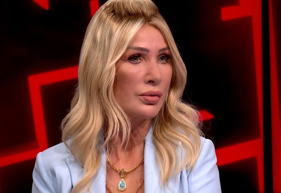 Seda Sayan'ın b&uuml;y&uuml;k değişimi! En son Fransız askısı ve dudak liftingi yaptırmıştı