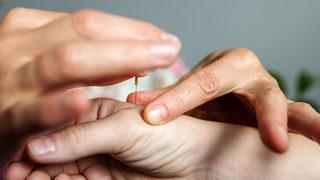 Alkol bağımlılığı tedavisinde nereye başvurulur sorusu akupunktur ile son buluyor! Klinik ortamda gerçekleştirilirse...