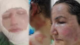 Diyarbakır'da vahşet! Çocuklarının gözü önünde eşini kızgın yağ ve kaynar suyla haşladı 