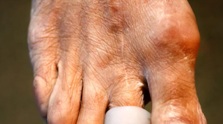 Görmezden gelmeyin! Ayaktaki ağrı birçok rahatsızlığı işaret ediyor 