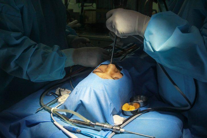 Ameliyathaneden paylaşıldı! Kara mantar ameliyatı böyle yapılıyor G3