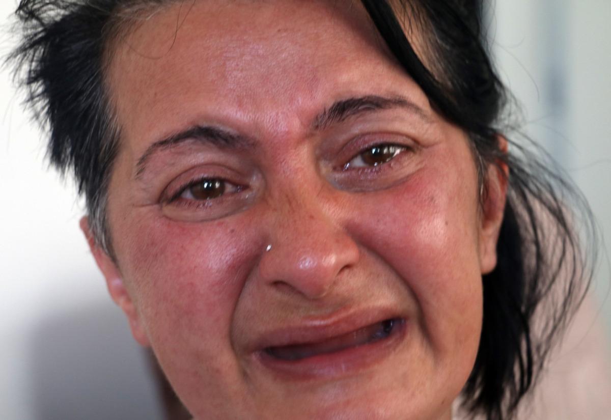 Beyaz diş hayaliyle 32 dişinden olmuş, &ouml;tanazi istiyordu! Şimdi g&uuml;l&uuml;c&uuml;kler sa&ccedil;ıyor