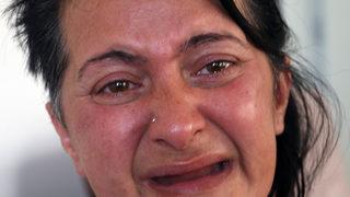 Beyaz diş hayaliyle 32 dişinden olmuş, ötanazi istiyordu! Şimdi gülücükler saçıyor