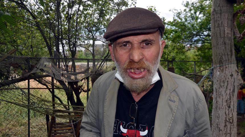 Komşu dehşeti! Keserle saldırıp dişlerini kırdı