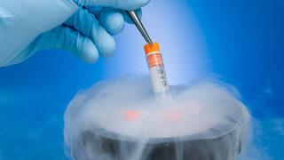 Kapsamlı kromozom taraması tüp bebek tedavisinde umut veriyor