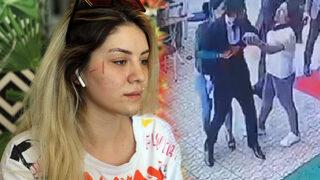 Düğün günü gelinin saçını yapan kuaföre damat ve akrabaları saldırdı