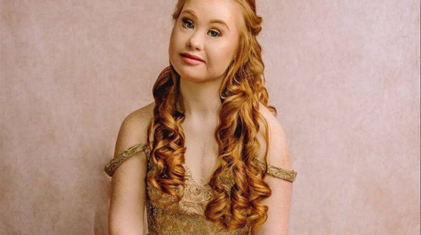 Modellik yaparak güzellik standartlarına meydan okudu! Down sendromlu model bütün güzellik tabularını yıktı