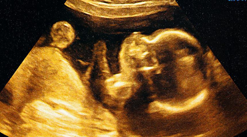 Anne karnında regresyon ile ceninken yaşadığınız travmalar gün yüzüne çıkıyor! 