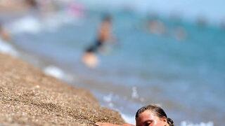 Uzman isim uyardı: Kontrolsüz güneşlenme kansere sebep oluyor