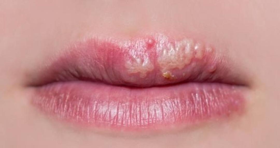 U&ccedil;uğu iki g&uuml;nde ge&ccedil;iriyor! O yağın mucizevi etkisi ortaya &ccedil;ıktı sonu&ccedil;lar inanılmaz