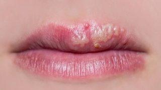 Uçuğu iki günde geçiriyor! O yağın mucizevi etkisi ortaya çıktı sonuçlar inanılmaz