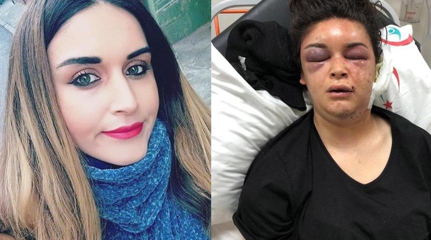 Boşanmak isteyen eşini kaçırarak işkence yapan koca ve ailesine hapis cezası