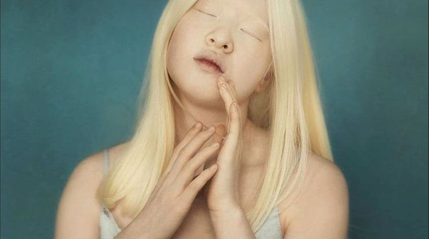 Hastalığı yüzünden bebekken terk edilen Xueli’nin yetimhaneden modelliğe uzanan hikayesi derinden etkileyecek