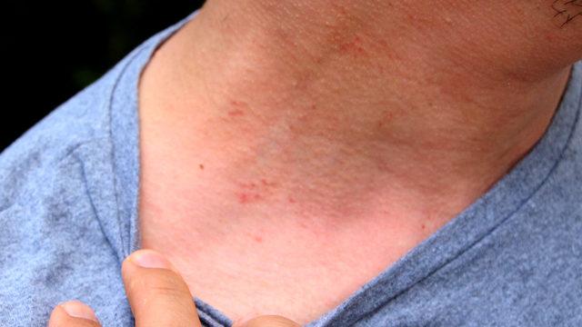 Trafikte yol verme kavgasında doktora dayak: Herhalde beni öldürecekti