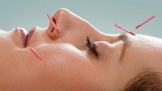 Sinüzit tedavisinde akupunktur yöntemi hangi durumda tercih ediliyor?