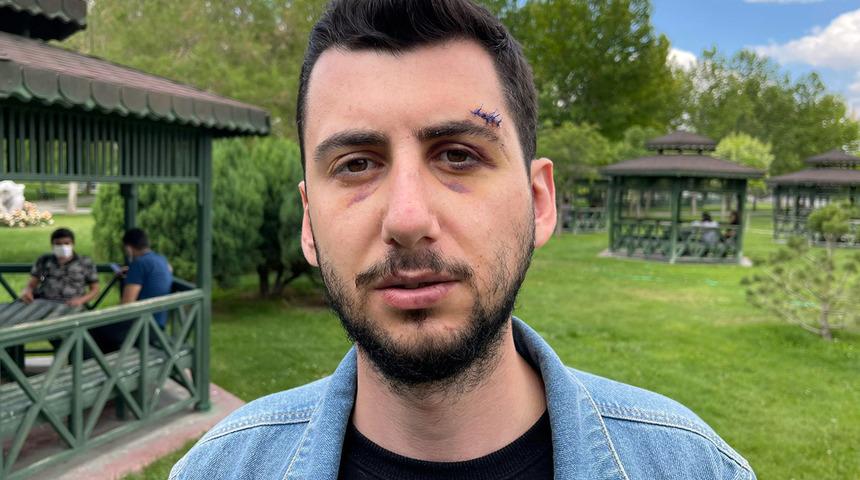 Kız arkadaşını korumak isterken dehşeti yaşadı! Muştayla defalarca vurdu