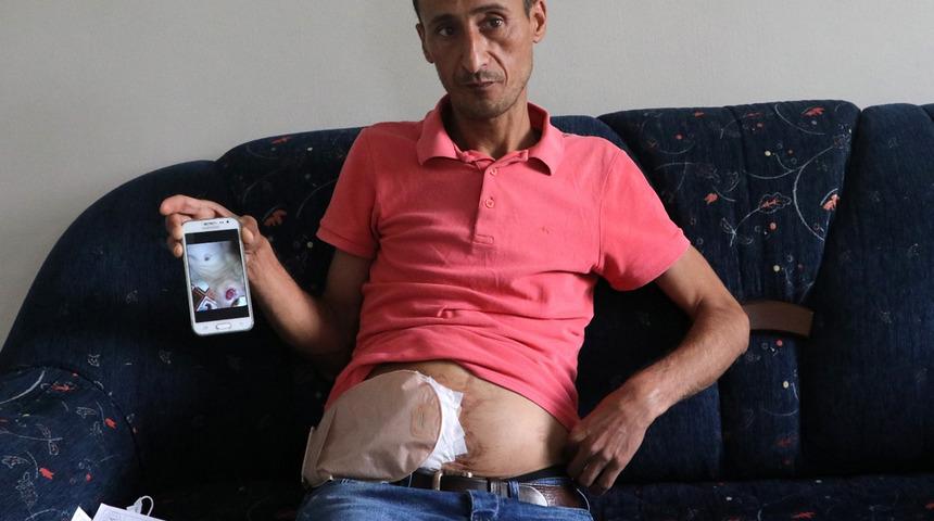 Bağırsakları vücudunun dışında olan adam yardım bekliyor