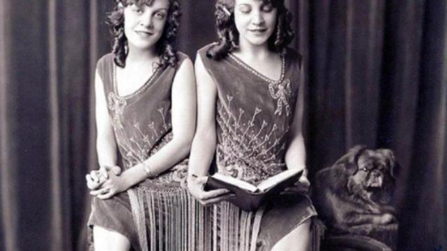 Yapışık ikiz olan Hilton kardeşlerin inanılmaz yaşam öyküsü! Hilton kardeşler sergilendi