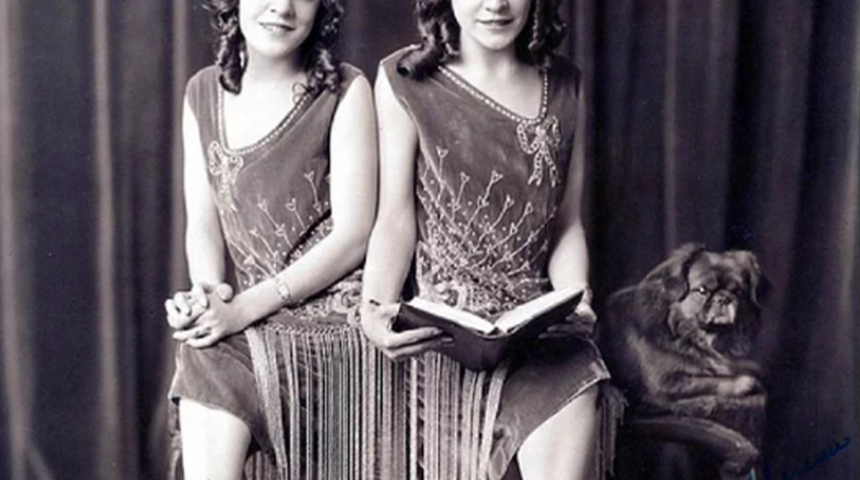 Yapışık ikiz olan Hilton kardeşlerin inanılmaz yaşam öyküsü! Hilton kardeşler sergilendi