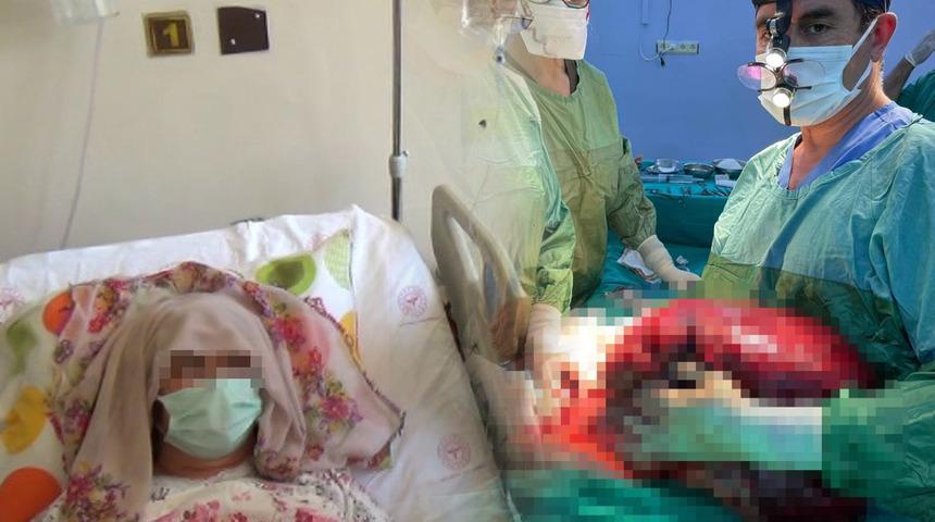 Safra kesesi şikayeti ile hastaneye gitti, karnından çıkan tümör şaşkına çevirdi: Ender rastlanan bir vaka