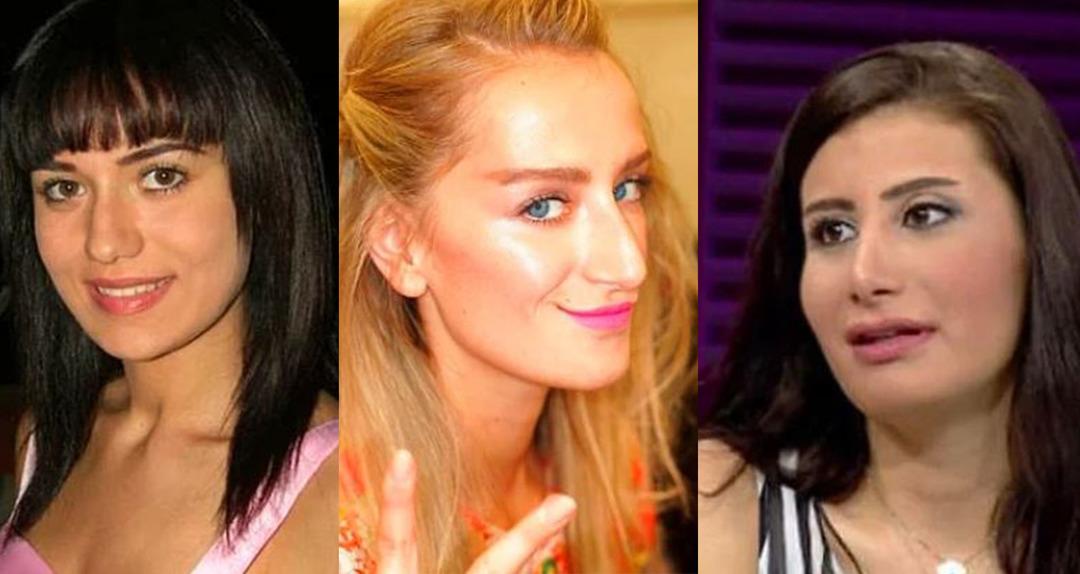 Adeta başka birine d&ouml;n&uuml;şt&uuml;ler! İşte &uuml;nl&uuml;lerin estetiksiz halleri